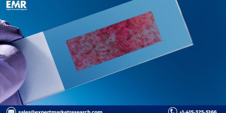 Biochips Based In-Vitro Diagnostics Market