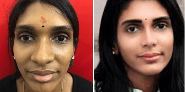 What are the primary Benefits of Nose Surgery?