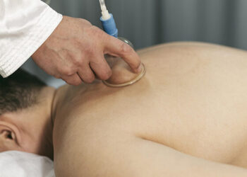 Cupping Therapy in Houston